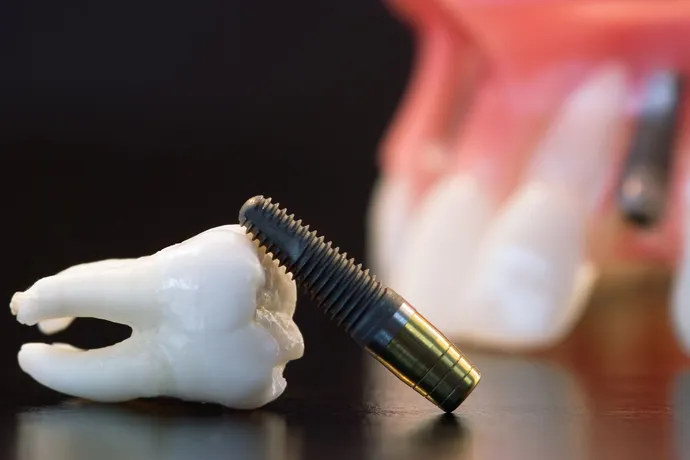 Ridge Augmentation and Sinus Lift Services